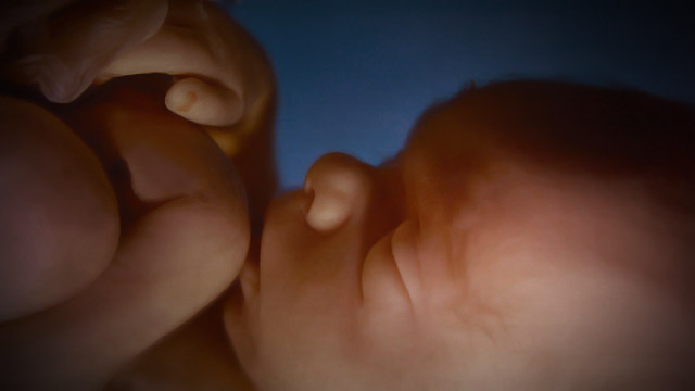 Estudo do documento "Nova Estratégia Mundial do Aborto" (III)