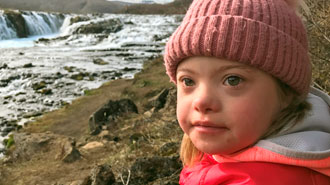 O modo perturbador como a Islândia está “erradicando” a síndrome de Down