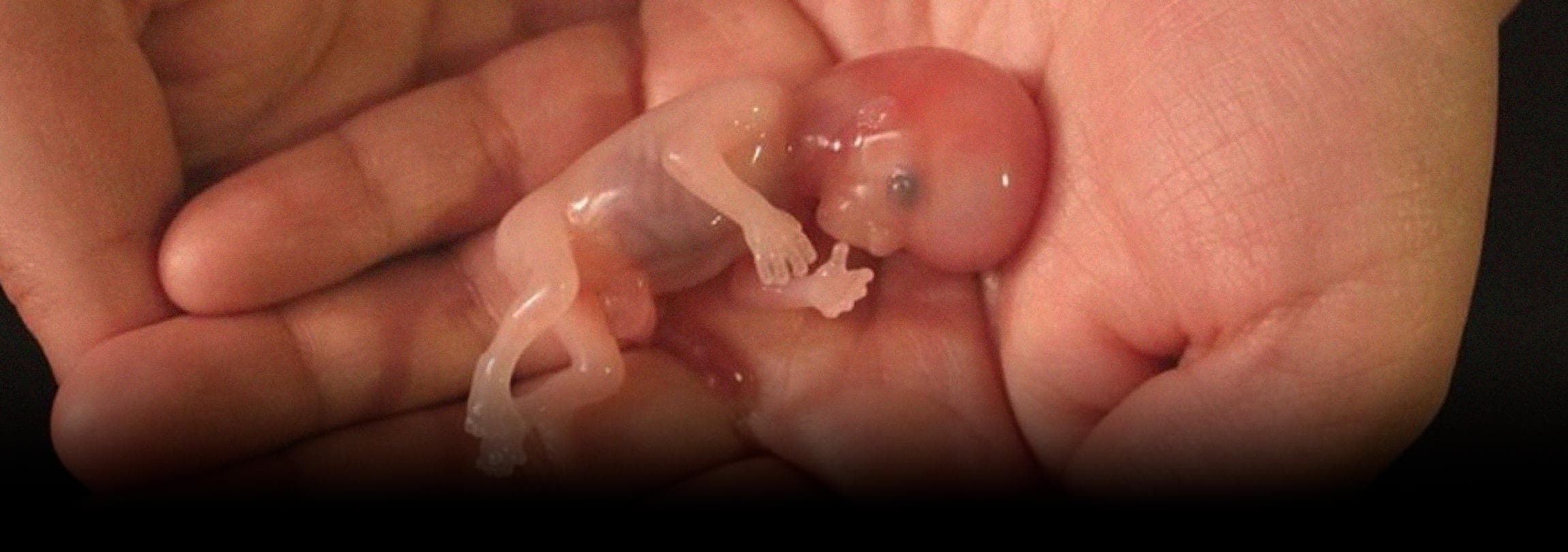 A mentira do “aborto seguro”