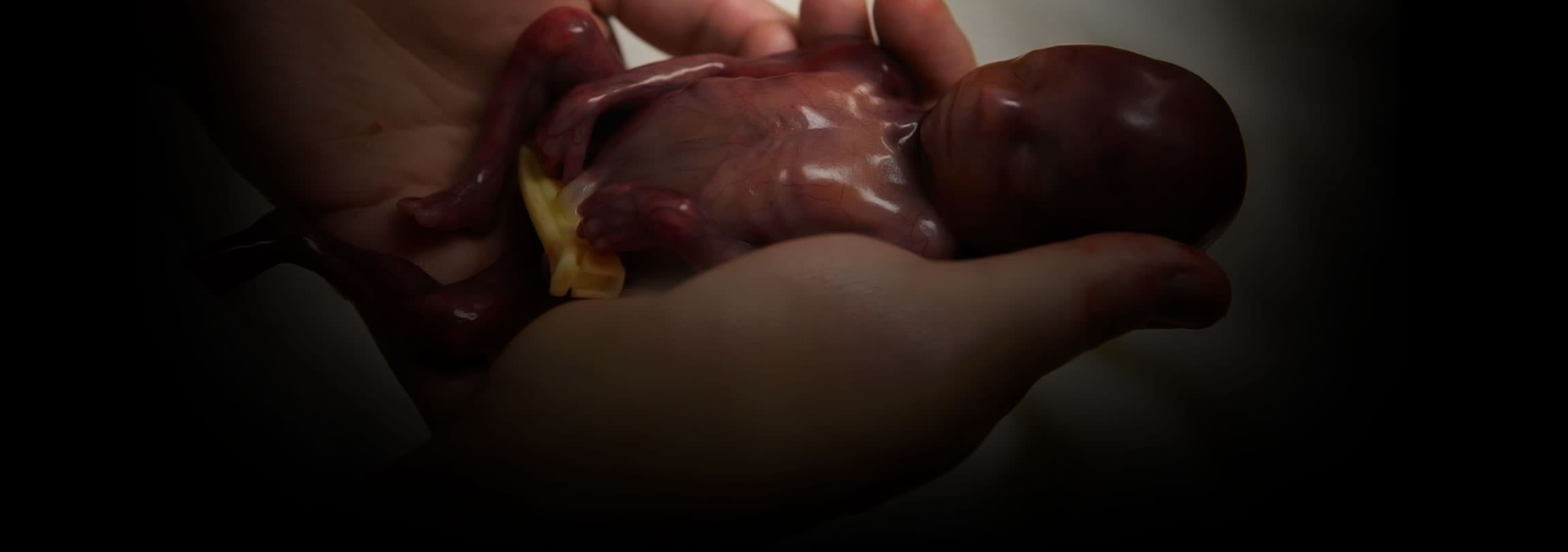 O bebê que está mudando o debate sobre o aborto